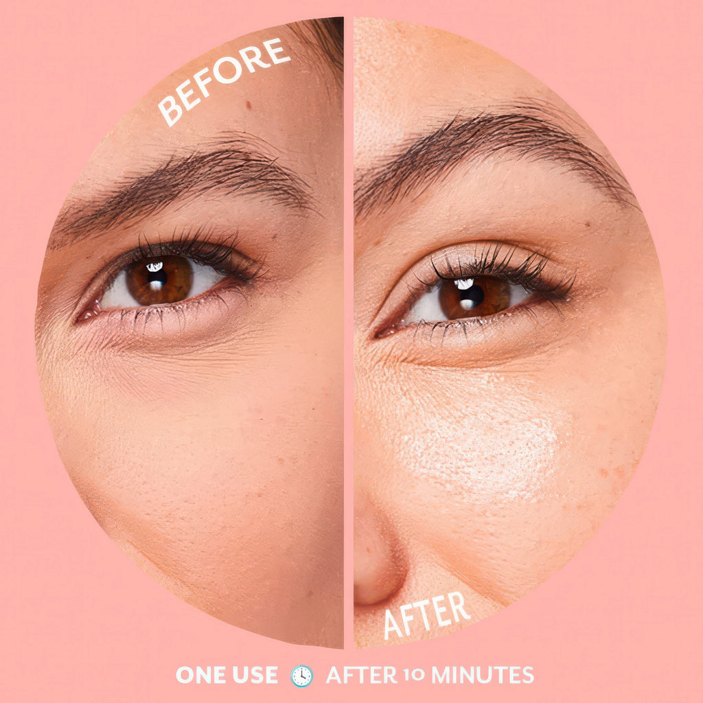 Before/after for using Serve Chilled Bubbly Brightening Eye Gel Single.