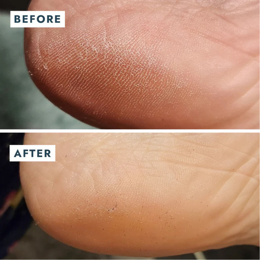 Solemate Heel Repair Balm before & after.